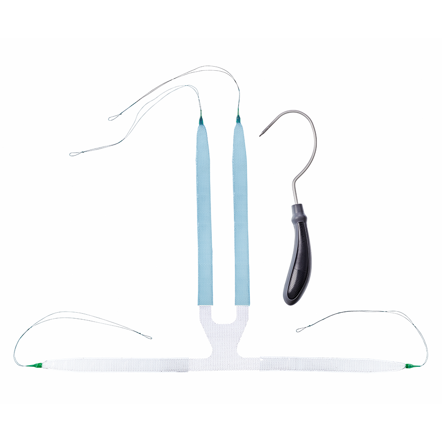 Advance Sling For Incontinence