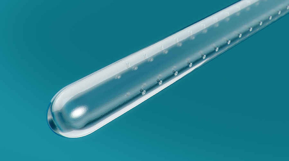 A catheter designed to reduce the risk of UTIs
